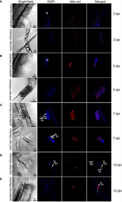 Lignin accumulation in cell wall plays a role in clubroot resistance